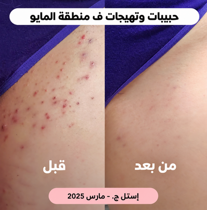 ماكينة إزالة الشعر 2 في 1 – بشرة ناعمة بسهولة