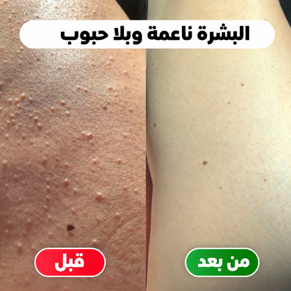 ماكينة إزالة الشعر 2 في 1 – بشرة ناعمة بسهولة